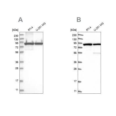 Western Blot: DDX1 Antibody [NBP1-85293]