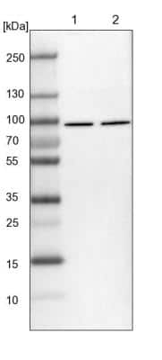 Western Blot: DDX1 Antibody [NBP1-85294]