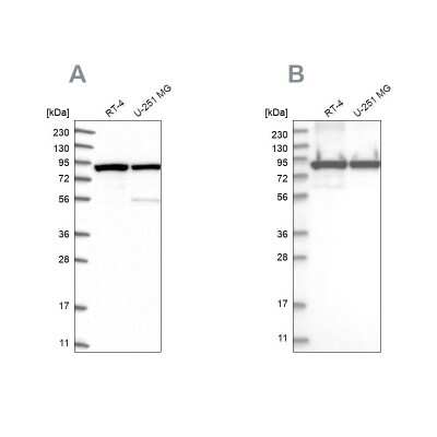 Western Blot: DDX1 Antibody [NBP1-85294]