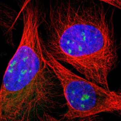 Immunocytochemistry/ Immunofluorescence: DDX10 Antibody [NBP1-83211]