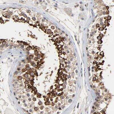 Immunohistochemistry-Paraffin: DDX10 Antibody [NBP1-83211]