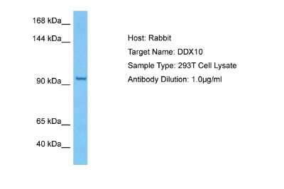 Western Blot: DDX10 Antibody [NBP2-87257]