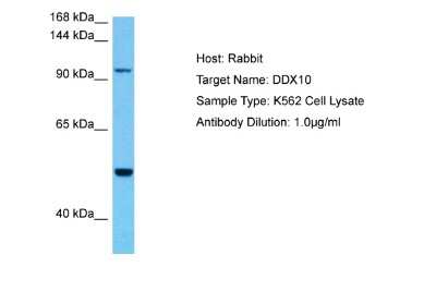 Western Blot: DDX10 Antibody [NBP2-87259]