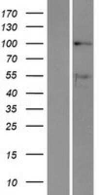 Western Blot: DDX10 Overexpression Lysate [NBP2-07875]