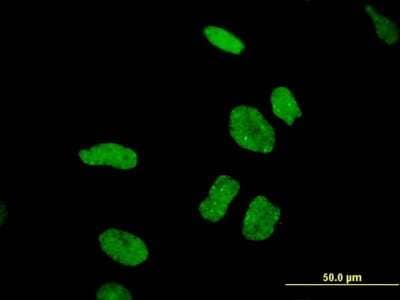 Immunocytochemistry/ Immunofluorescence: DDX11 Antibody (3C1) [H00001663-M03]