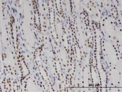 Immunohistochemistry-Paraffin: DDX11 Antibody (3C1) [H00001663-M03]
