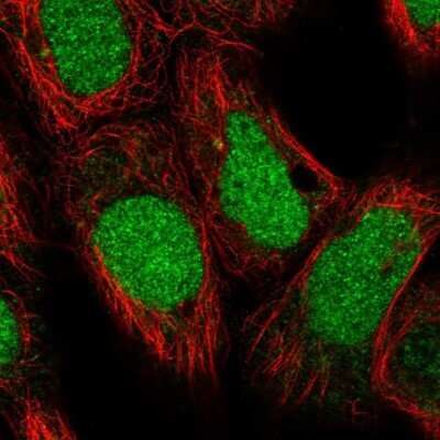 Immunocytochemistry/ Immunofluorescence: DDX11 Antibody [NBP2-38060]