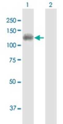 Western Blot: DDX11 Antibody [H00001663-B01P]