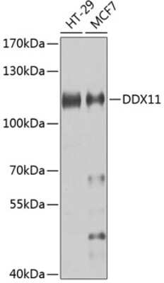 Western Blot: DDX11 AntibodyBSA Free [NBP2-92510]