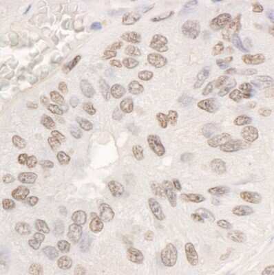 Immunohistochemistry-Paraffin: DDX17 Antibody [NB200-352]