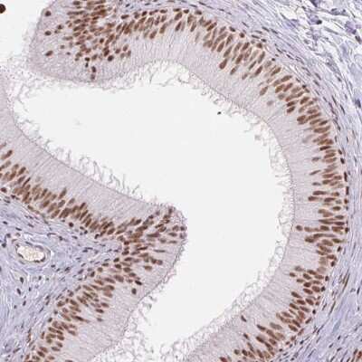 Immunohistochemistry-Paraffin: DDX17 Antibody [NBP2-38985]