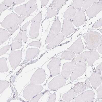 Immunohistochemistry-Paraffin: DDX17 Antibody [NBP2-38985]