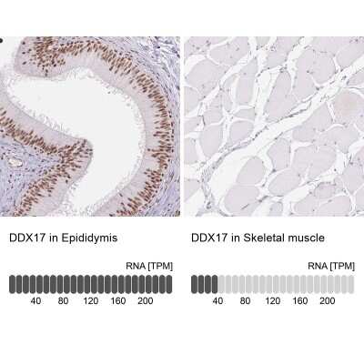 Immunohistochemistry-Paraffin: DDX17 Antibody [NBP2-38985]