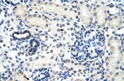Immunohistochemistry-Paraffin: DDX17 Antibody [NBP2-87262]