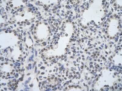 Immunohistochemistry-Paraffin: DDX17 Antibody [NBP2-87262]