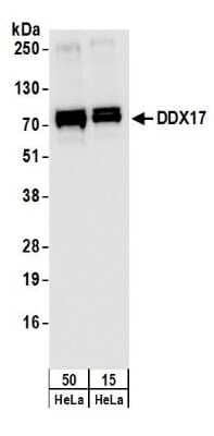 Western Blot: DDX17 Antibody [NB200-352]