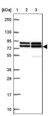 Western Blot: DDX17 Antibody [NBP2-38985]