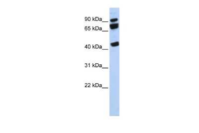 Western Blot: DDX17 Antibody [NBP2-87261]