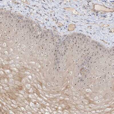 Immunohistochemistry-Paraffin: DDX18 Antibody [NBP1-81038]