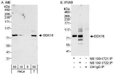 Western Blot: DDX18 Antibody [NB100-1722]