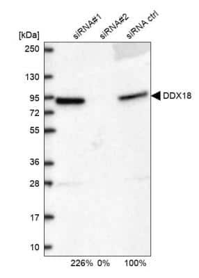 Western Blot: DDX18 Antibody [NBP2-58939]