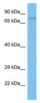 Western Blot: DDX18 Antibody [NBP3-10824]