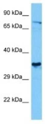 Western Blot: DDX18 Antibody [NBP3-10825]