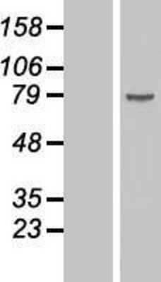 Western Blot: DDX18 Overexpression Lysate [NBL1-09783]