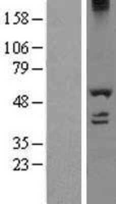 Western Blot: DDX19A Overexpression Lysate [NBL1-09784]