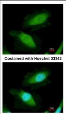 Immunocytochemistry/ Immunofluorescence: DDX19B Antibody [NBP2-16127]
