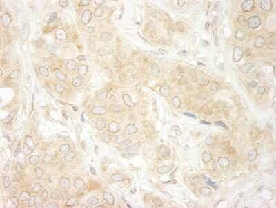 Immunohistochemistry: DDX19B Antibody [NB100-760]