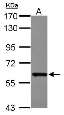 Western Blot: DDX19B Antibody [NBP2-16126]