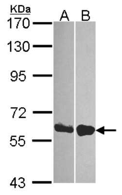 Western Blot: DDX19B Antibody [NBP2-16127]