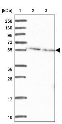 Western Blot: DDX19B Antibody [NBP2-33462]