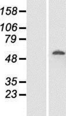 Western Blot: DDX19B Overexpression Lysate [NBP2-08740]