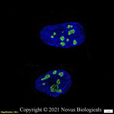 Immunocytochemistry/ Immunofluorescence: DDX21 Antibody - BSA Free [NB100-1718]