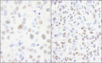 Immunohistochemistry: DDX21 Antibody - BSA Free [NB100-1718]