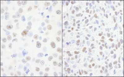 Immunohistochemistry: DDX21 Antibody - BSA Free [NB100-1718]