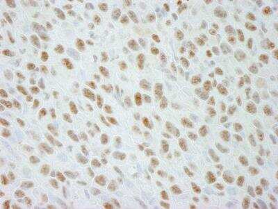 Immunohistochemistry-Paraffin: DDX21 Antibody - BSA Free [NB100-1718]