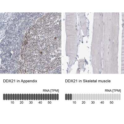 Immunohistochemistry-Paraffin: DDX21 Antibody [NBP1-83310]