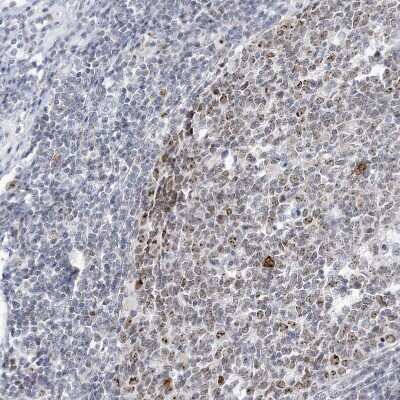 Immunohistochemistry-Paraffin: DDX21 Antibody [NBP1-83310]