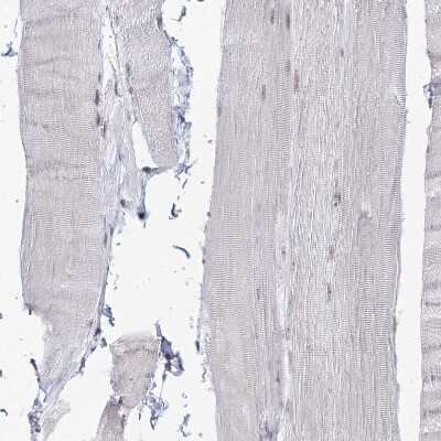 Immunohistochemistry-Paraffin: DDX21 Antibody [NBP1-83310]