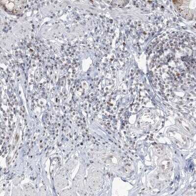 Immunohistochemistry-Paraffin: DDX21 Antibody [NBP2-38311]