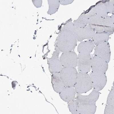 Immunohistochemistry-Paraffin: DDX21 Antibody [NBP2-38311]