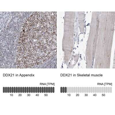 Immunohistochemistry-Paraffin: DDX21 Antibody [NBP2-38311]
