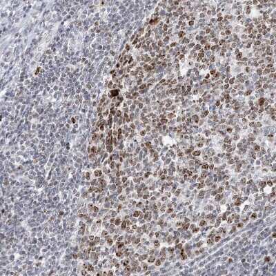 Immunohistochemistry-Paraffin: DDX21 Antibody [NBP2-38311]