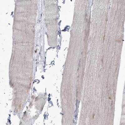 Immunohistochemistry-Paraffin: DDX21 Antibody [NBP2-38311]