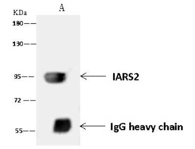 Immunoprecipitation: DDX21 Antibody [NBP2-97537]
