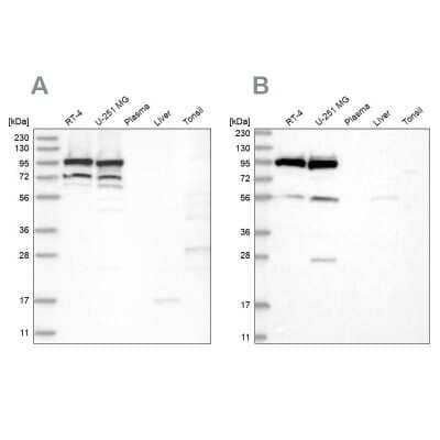 Western Blot: DDX21 Antibody [NBP2-38311]