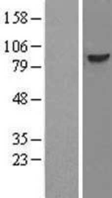 Western Blot: DDX21 Overexpression Lysate [NBL1-09787]